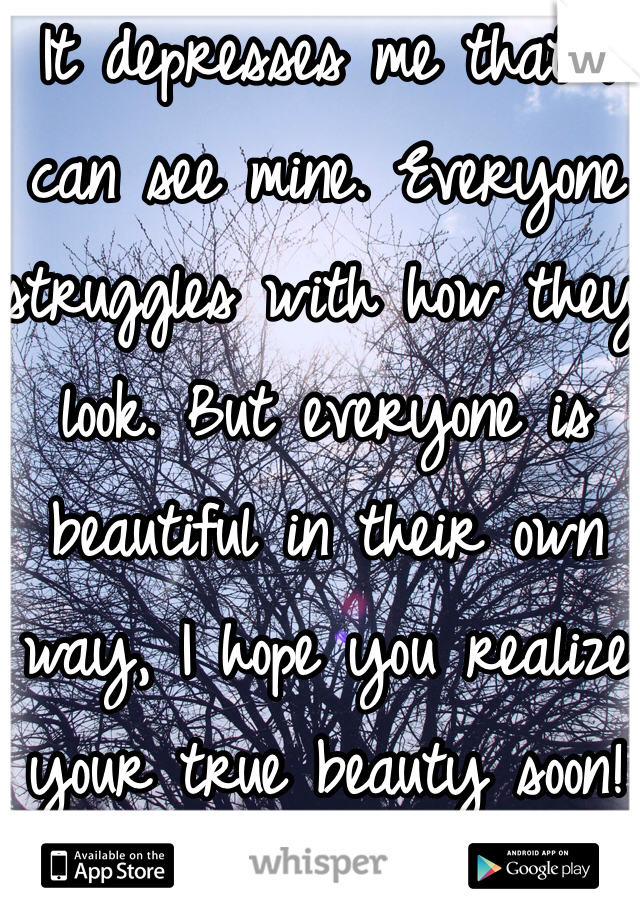 It depresses me that I can see mine. Everyone struggles with how they look. But everyone is beautiful in their own way, I hope you realize your true beauty soon!