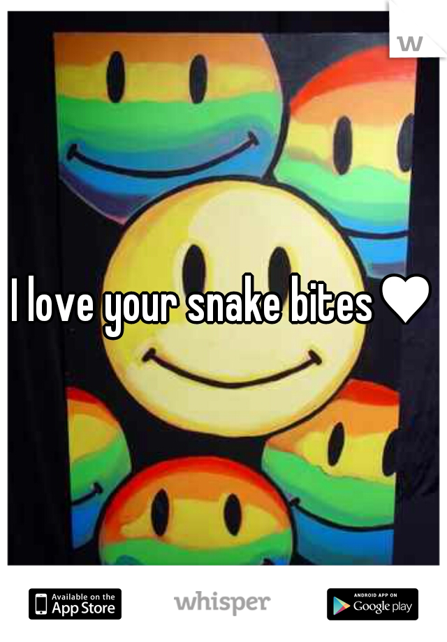 I love your snake bites♥