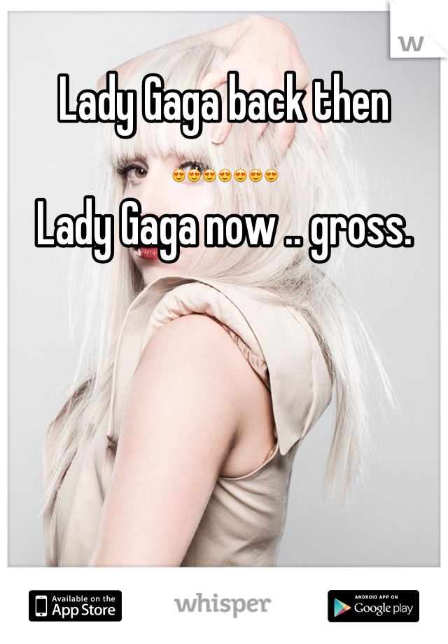 Lady Gaga back then 😍😍😍😍😍😍😍
Lady Gaga now .. gross.