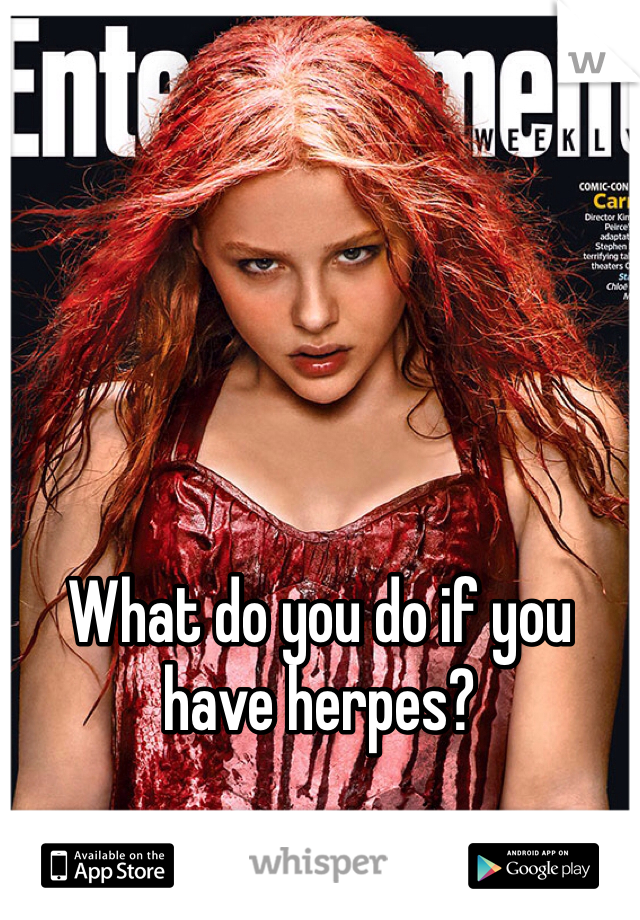 




What do you do if you have herpes?