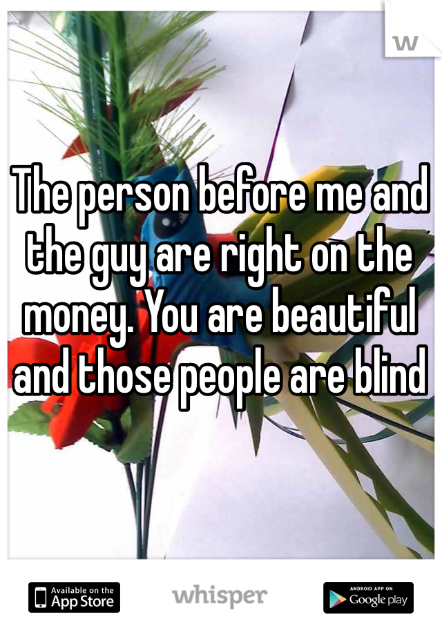 The person before me and the guy are right on the money. You are beautiful and those people are blind 