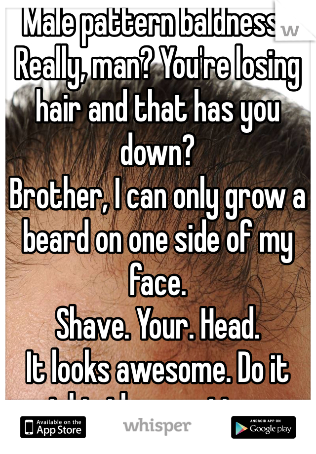 Male pattern baldness? 
Really, man? You're losing hair and that has you down? 
Brother, I can only grow a beard on one side of my face. 
Shave. Your. Head. 
It looks awesome. Do it right, throw a tie on, instant class. 