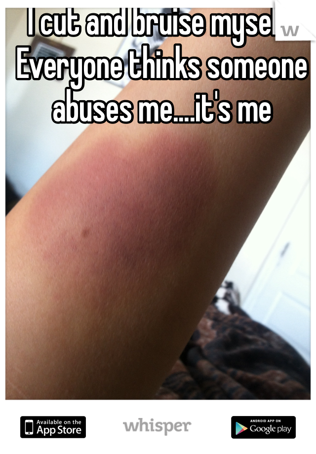 I cut and bruise myself. Everyone thinks someone abuses me....it's me