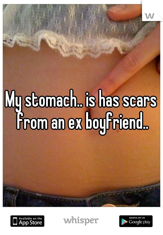 My stomach.. is has scars from an ex boyfriend..