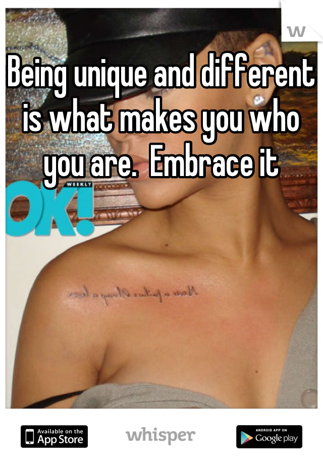 Being unique and different is what makes you who you are.  Embrace it