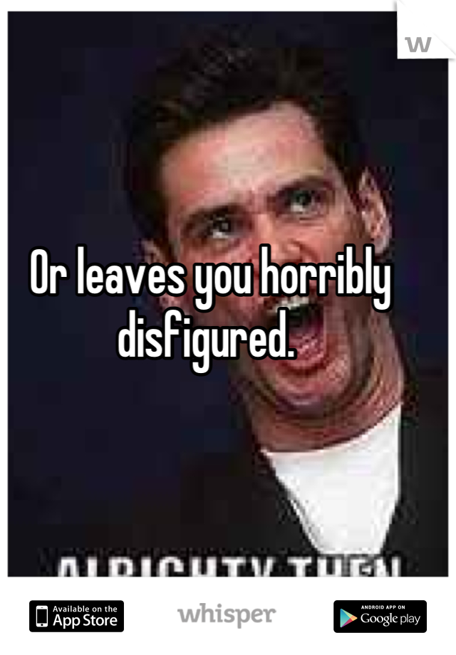 Or leaves you horribly disfigured. 