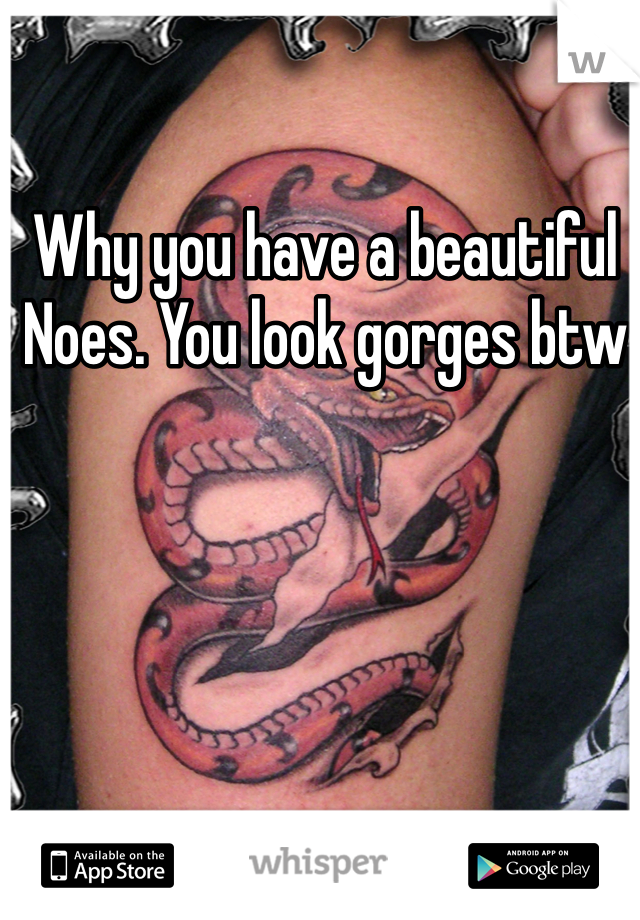 Why you have a beautiful Noes. You look gorges btw  