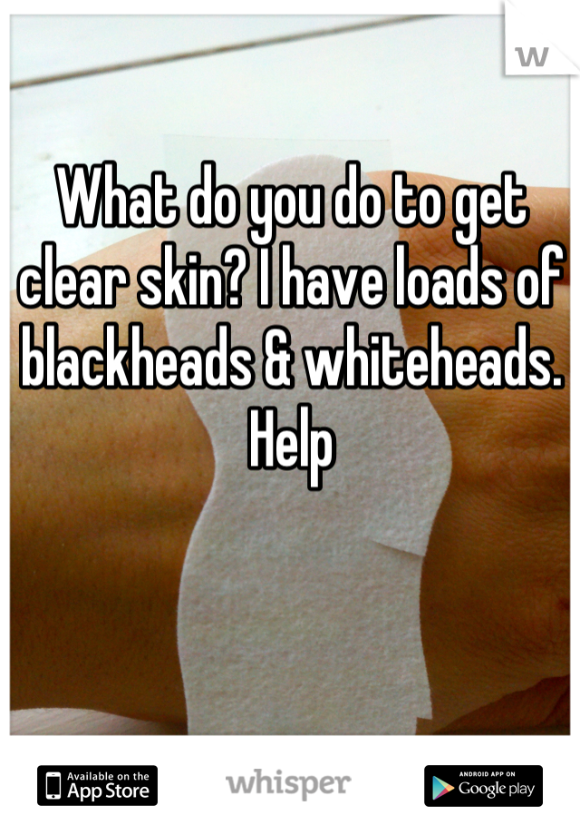 What do you do to get clear skin? I have loads of blackheads & whiteheads. Help