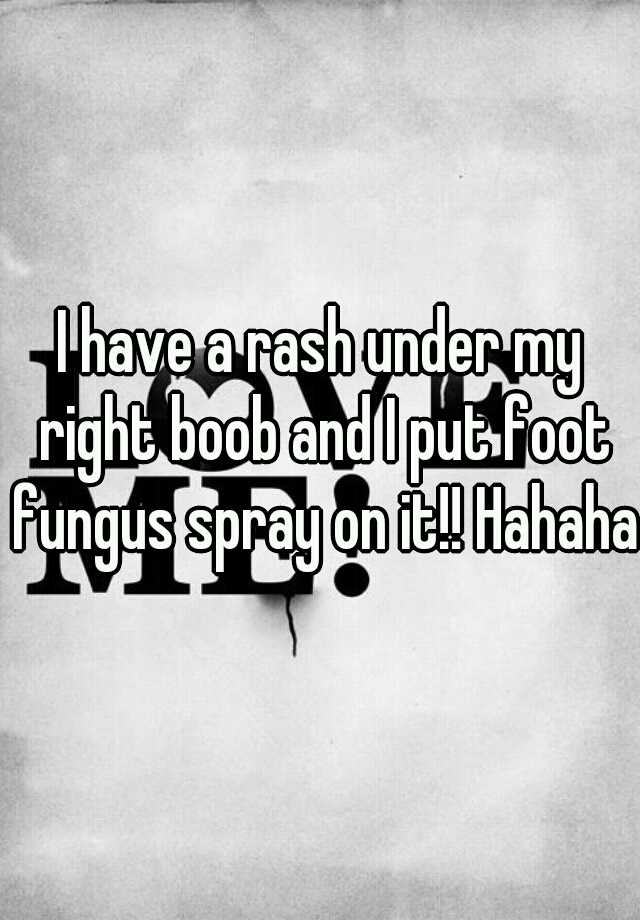 i-have-a-rash-under-my-right-boob-and-i-put-foot-fungus-spray-on-it