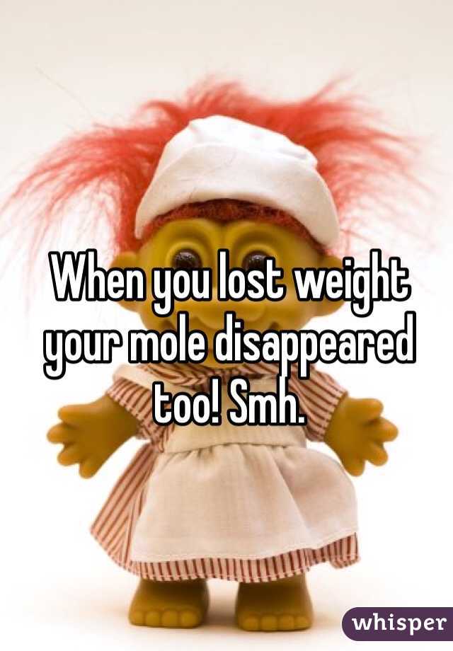 When you lost weight your mole disappeared too! Smh. 