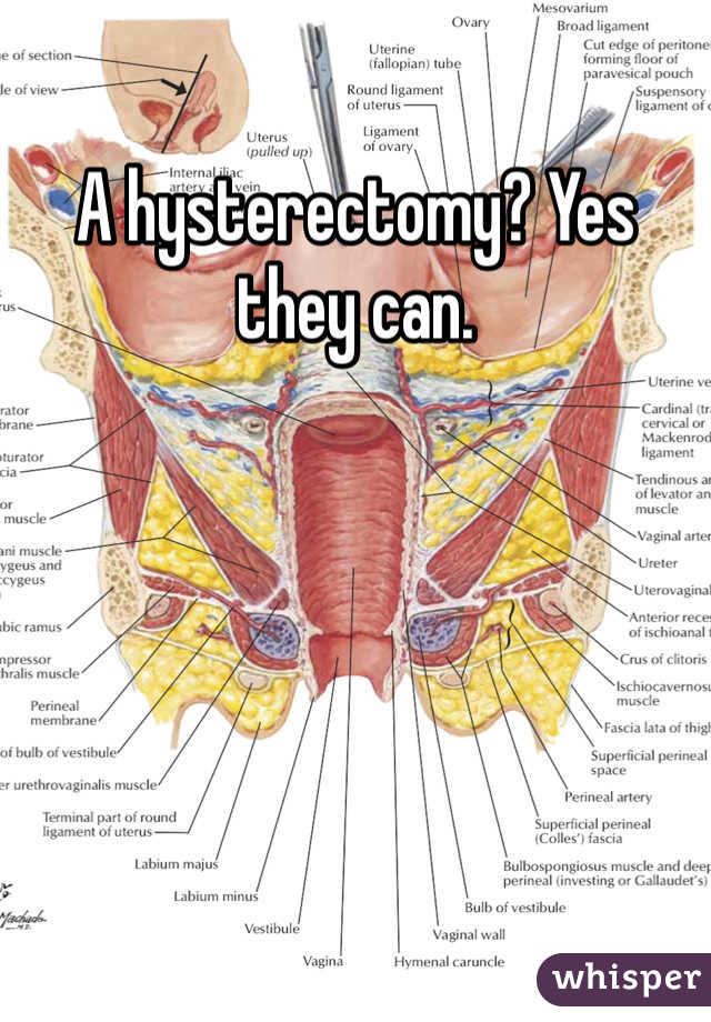 A hysterectomy? Yes they can. 