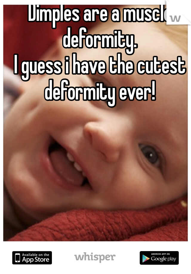 Dimples are a muscle deformity. 
I guess i have the cutest deformity ever!
