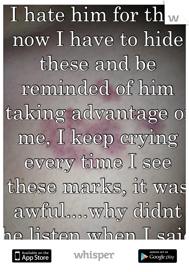 I hate him for this, now I have to hide these and be reminded of him taking advantage of me, I keep crying every time I see these marks, it was awful....why didnt he listen when I said leave me alone? 