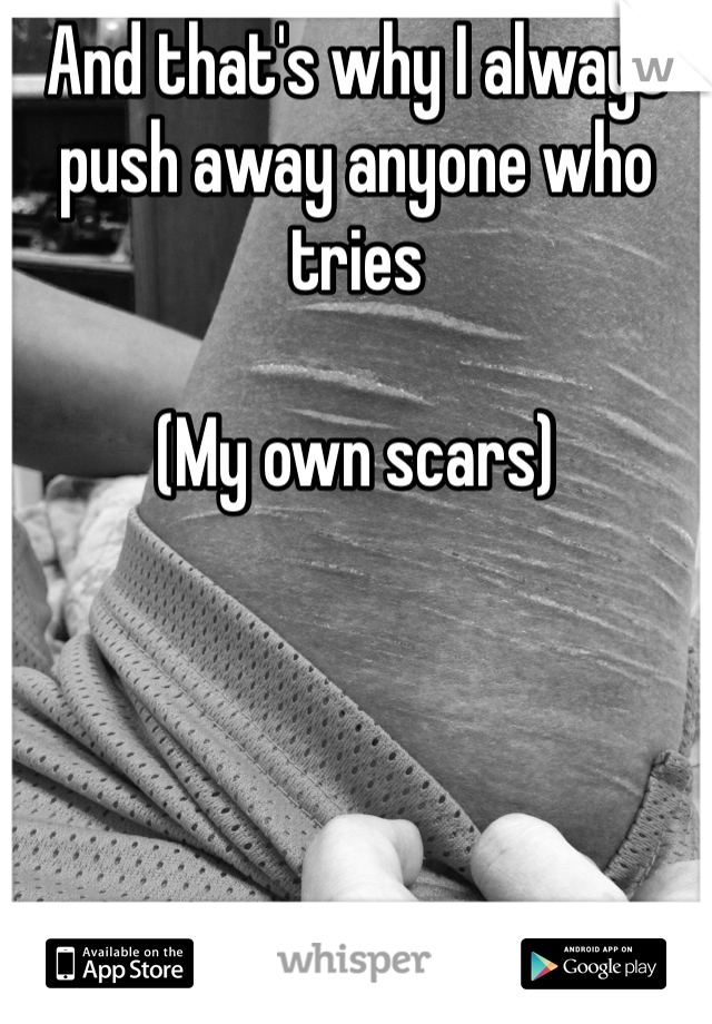 And that's why I always push away anyone who tries 

(My own scars)