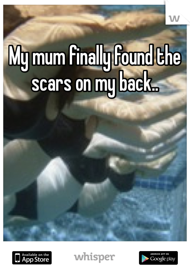 My mum finally found the scars on my back.. 