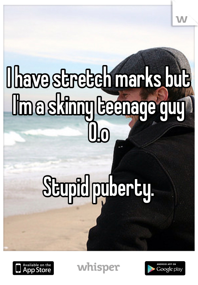 I have stretch marks but I'm a skinny teenage guy O.o

Stupid puberty.