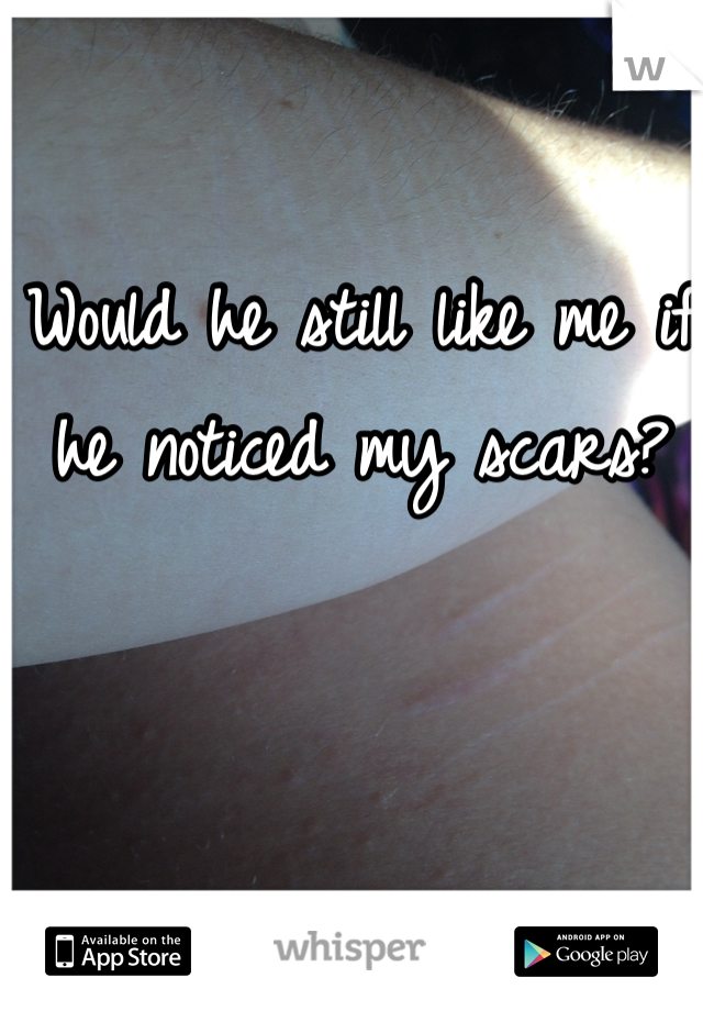 Would he still like me if he noticed my scars?