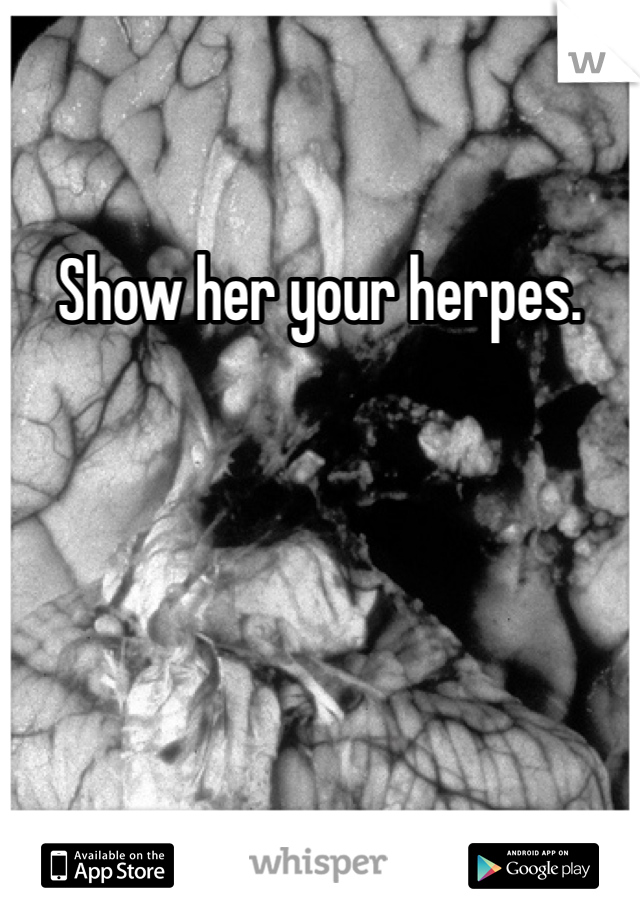 Show her your herpes. 