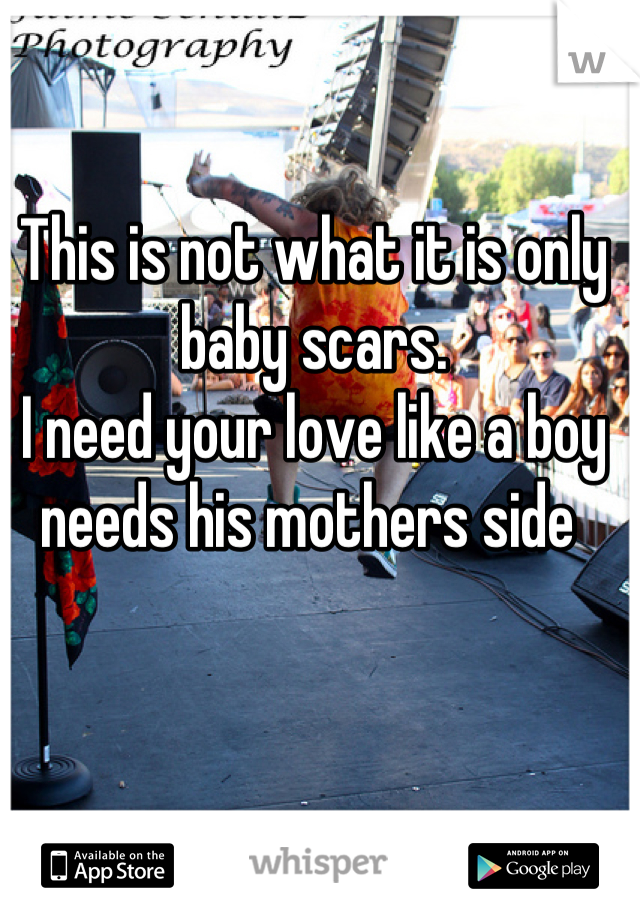 This is not what it is only baby scars. 
I need your love like a boy needs his mothers side 