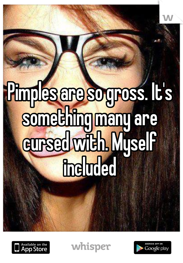 Pimples are so gross. It's something many are cursed with. Myself included 