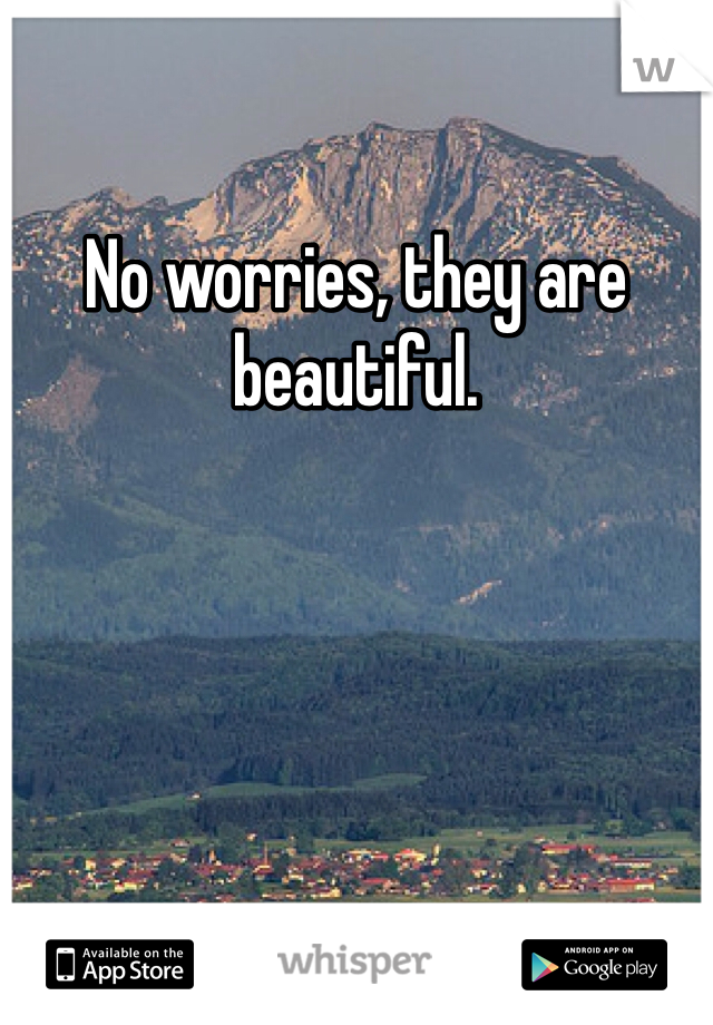 No worries, they are beautiful.