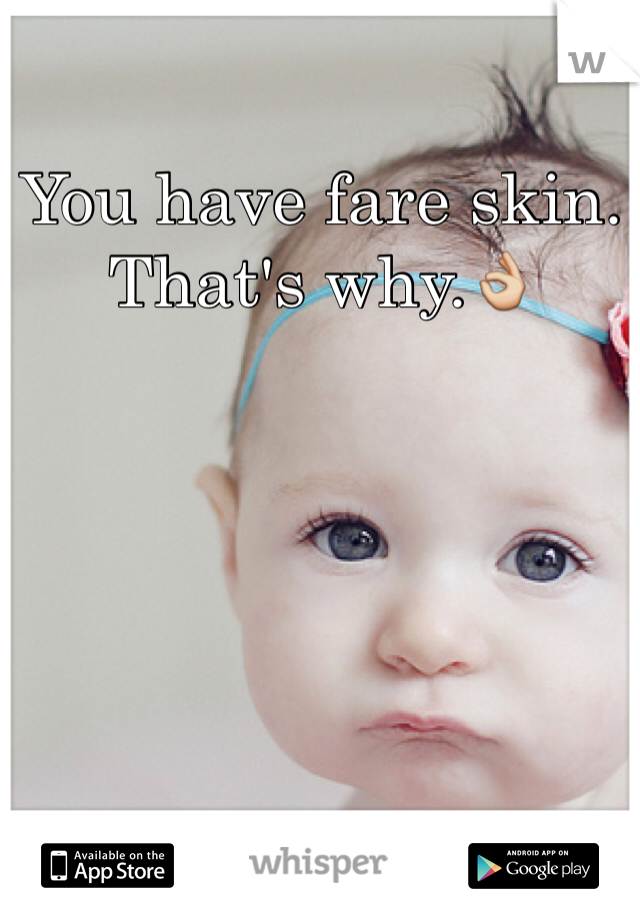 You have fare skin.
That's why.👌
