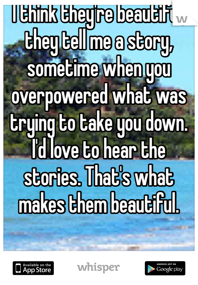 I think they're beautiful, they tell me a story, sometime when you overpowered what was trying to take you down. I'd love to hear the stories. That's what makes them beautiful.