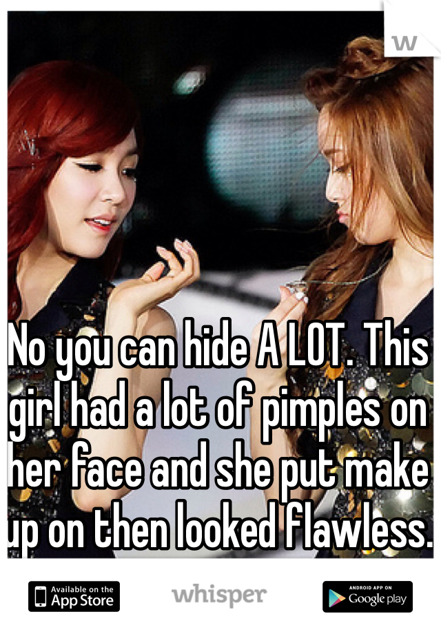 No you can hide A LOT. This girl had a lot of pimples on her face and she put make up on then looked flawless. 