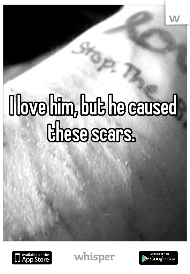 I love him, but he caused these scars. 