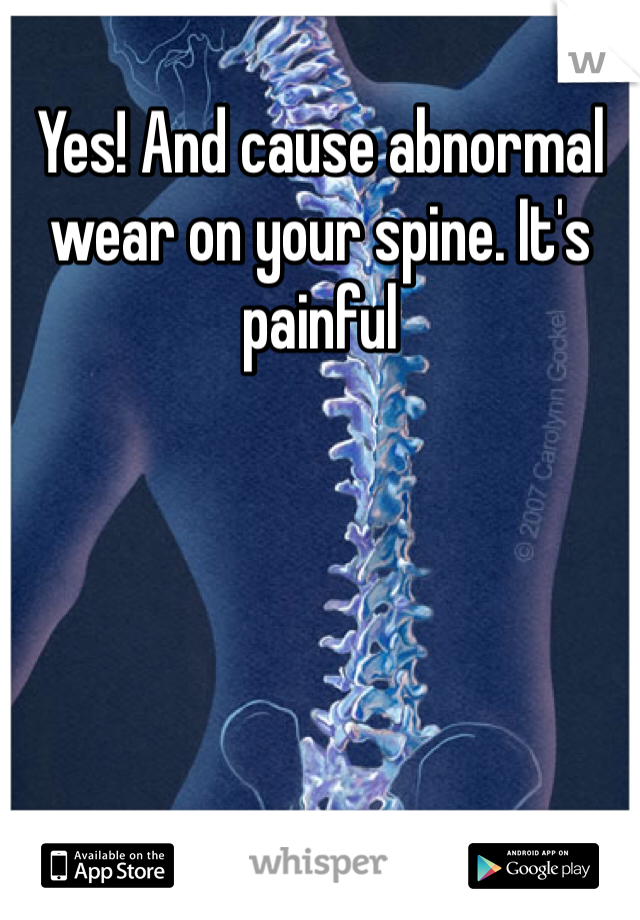 Yes! And cause abnormal wear on your spine. It's painful