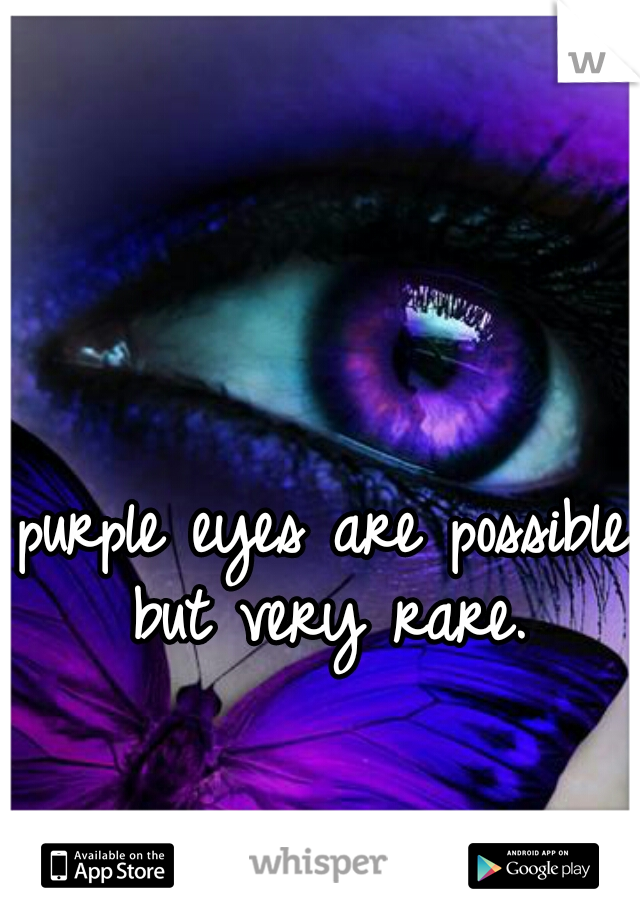 purple eyes are possible. but very rare. 