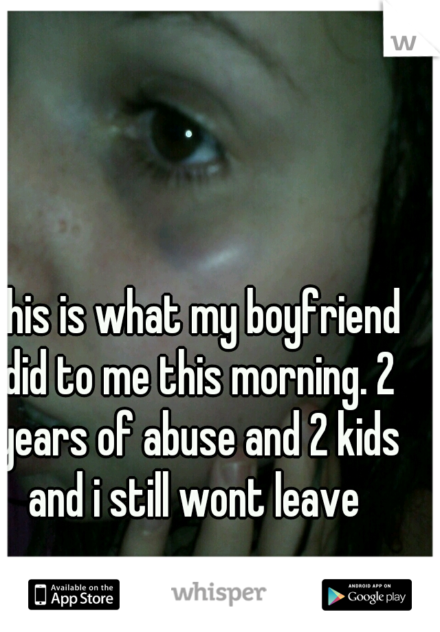 this is what my boyfriend did to me this morning. 2 years of abuse and 2 kids and i still wont leave 