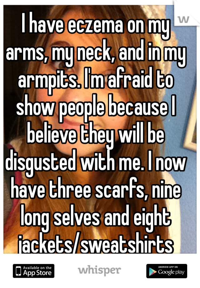 I have eczema on my arms, my neck, and in my armpits. I'm afraid to show people because I believe they will be disgusted with me. I now have three scarfs, nine long selves and eight jackets/sweatshirts 