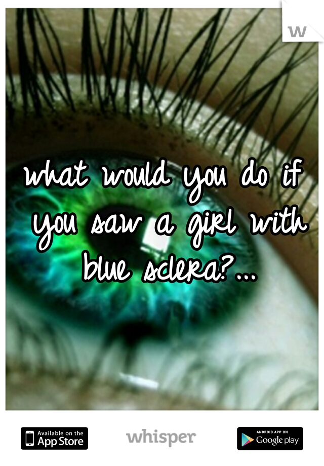 what would you do if you saw a girl with blue sclera?...
