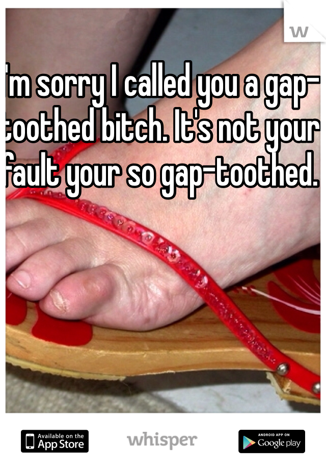 I'm sorry I called you a gap-toothed bitch. It's not your fault your so gap-toothed. 