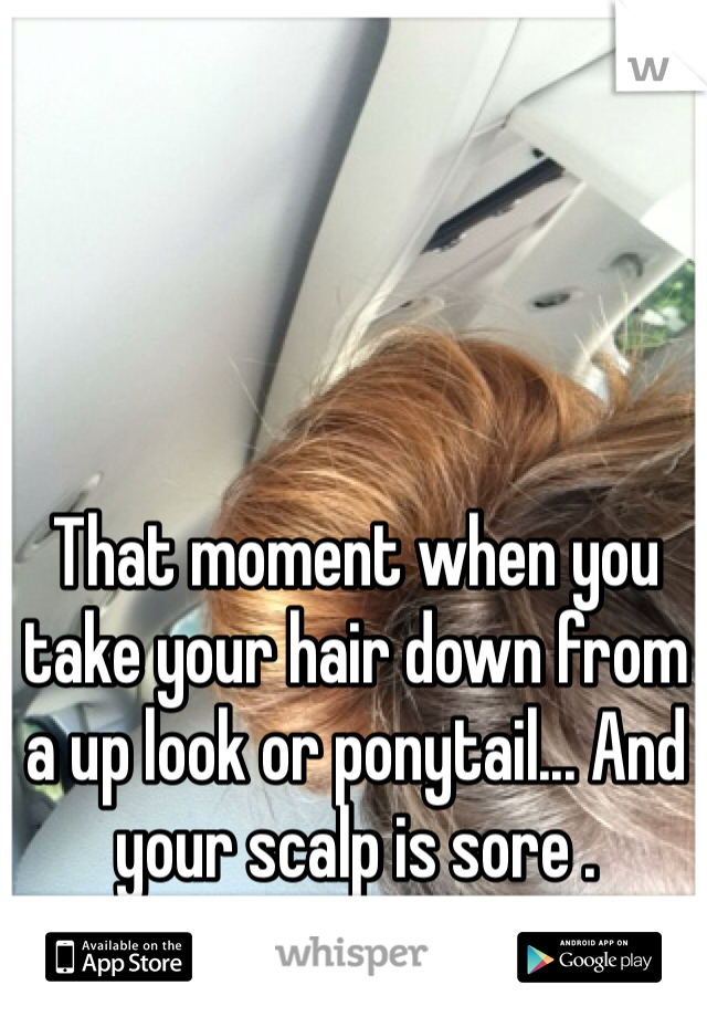 That moment when you take your hair down from a up look or ponytail... And your scalp is sore .