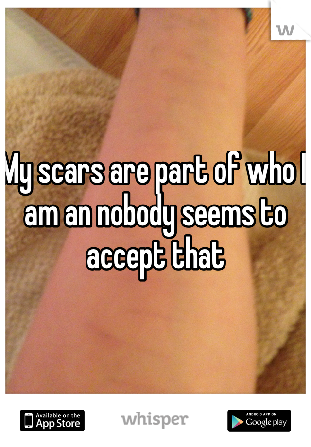 My scars are part of who I am an nobody seems to accept that 