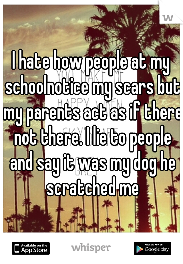 I hate how people at my schoolnotice my scars but my parents act as if there not there. I lie to people and say it was my dog he scratched me