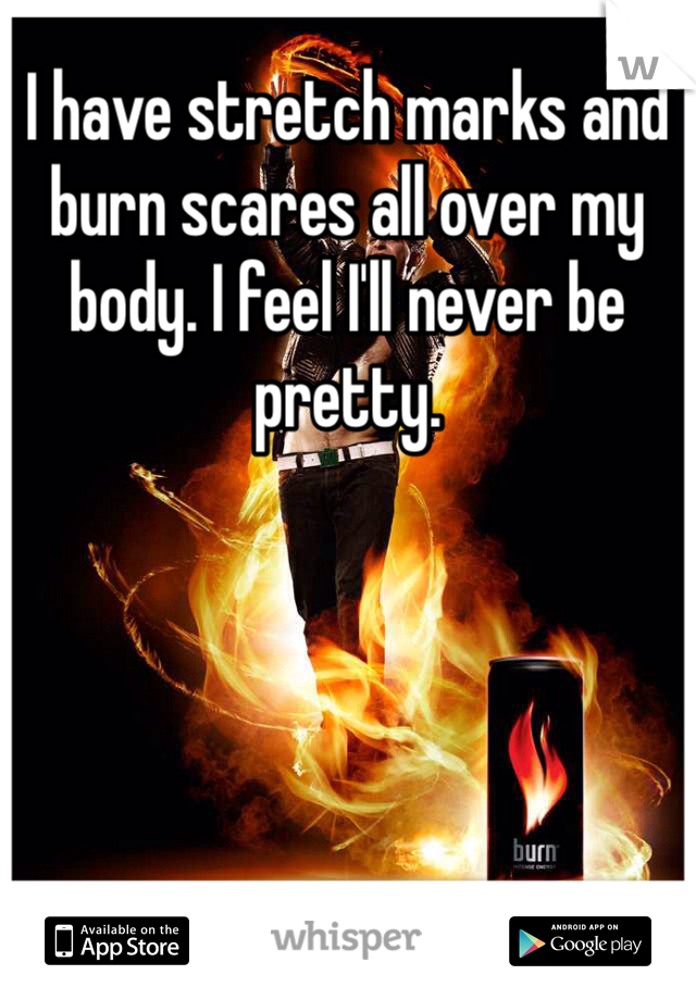 I have stretch marks and burn scares all over my body. I feel I'll never be pretty. 