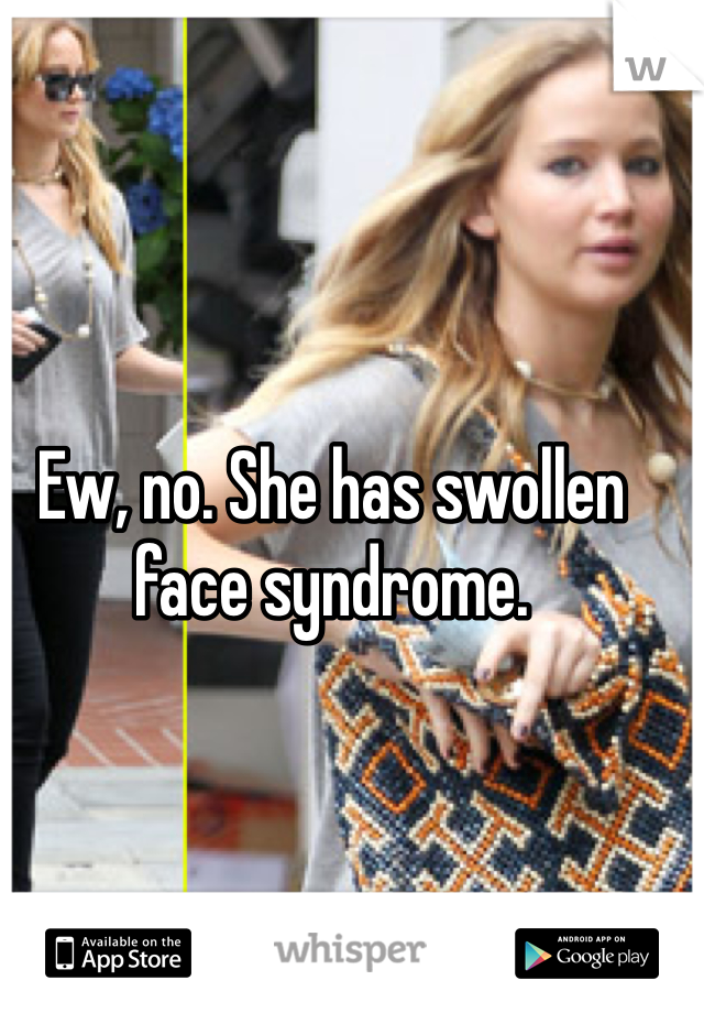 Ew, no. She has swollen face syndrome.