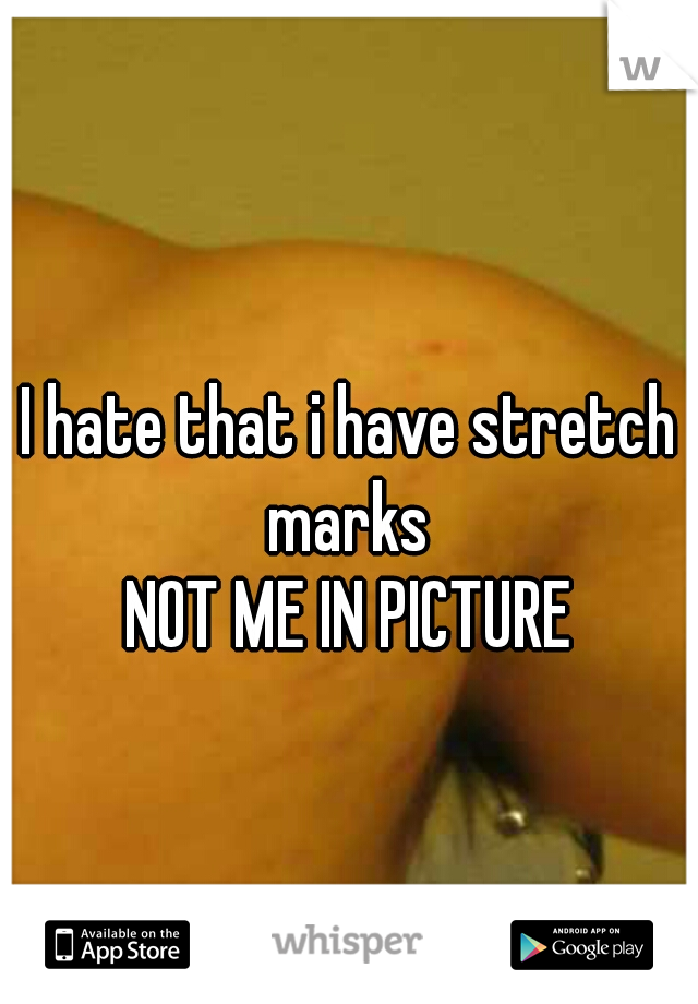 I hate that i have stretch marks 
NOT ME IN PICTURE