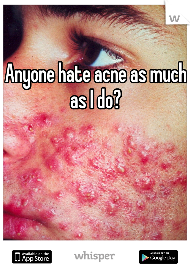 Anyone hate acne as much as I do?