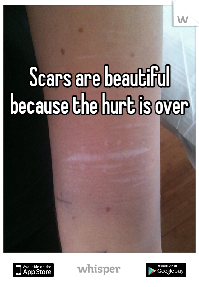 Scars are beautiful because the hurt is over