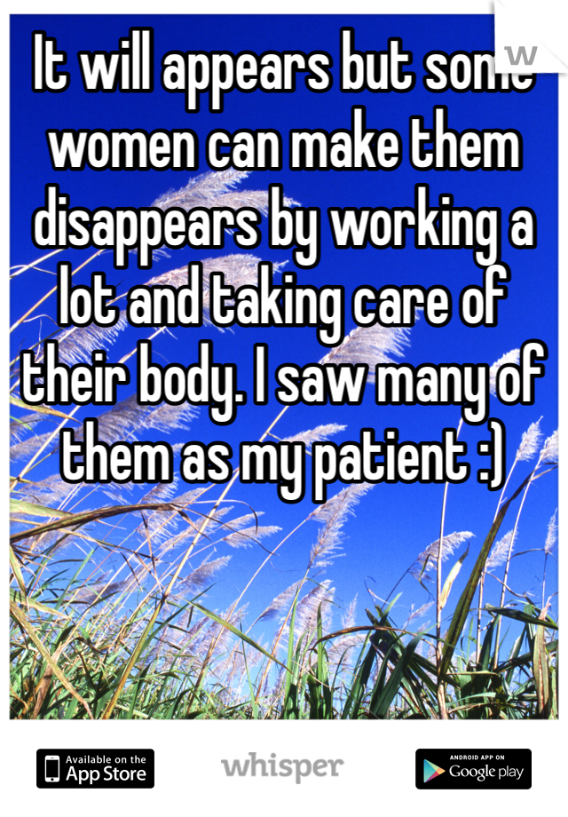 It will appears but some women can make them disappears by working a lot and taking care of their body. I saw many of them as my patient :) 