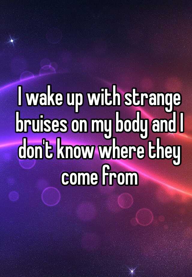 i-wake-up-with-strange-bruises-on-my-body-and-i-don-t-know-where-they