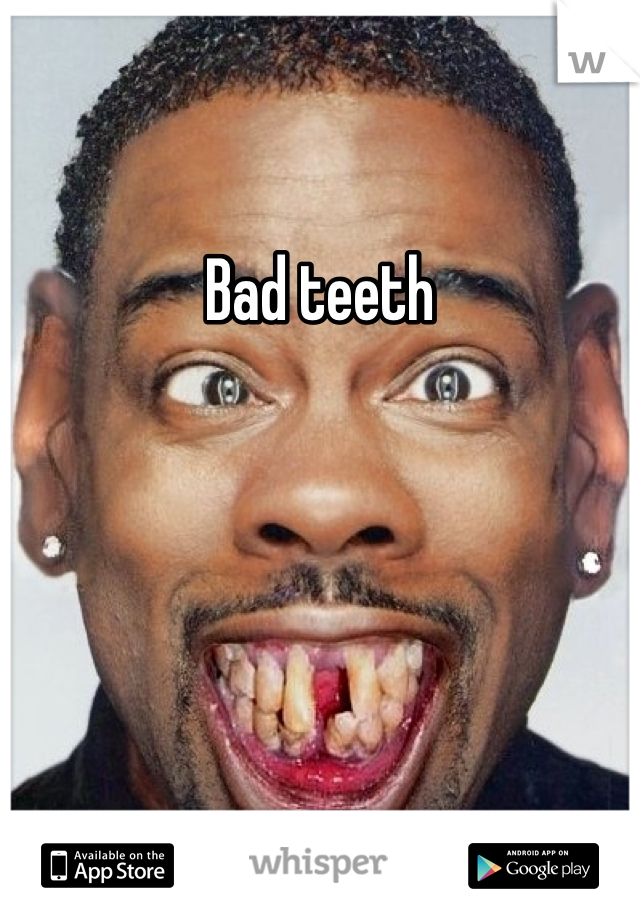 Bad teeth 