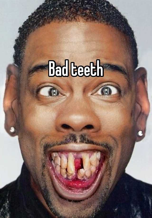 Bad Teeth