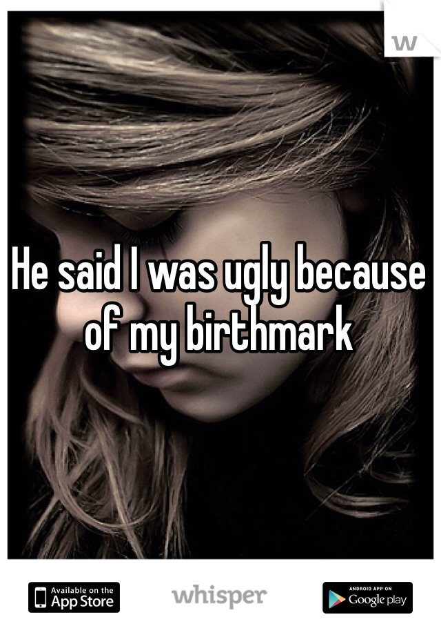 He said I was ugly because of my birthmark