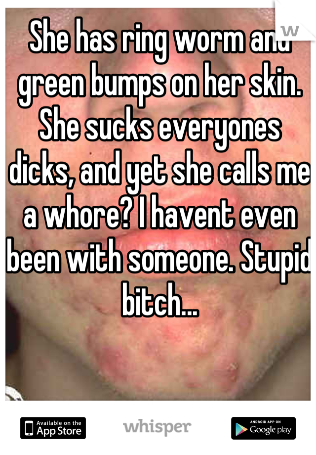 She has ring worm and green bumps on her skin. She sucks everyones dicks, and yet she calls me a whore? I havent even been with someone. Stupid bitch...