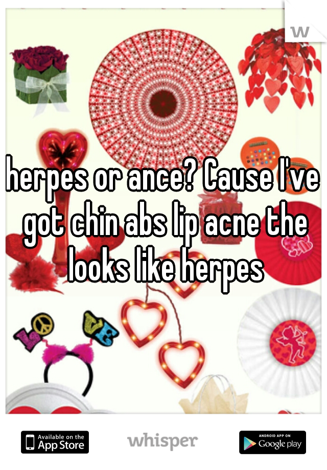 herpes or ance? Cause I've got chin abs lip acne the looks like herpes